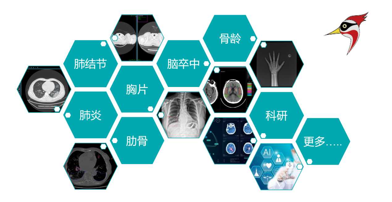 AI影像輔助云診斷解決方案